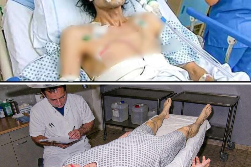 What Doctors Found Inside Michael Jackson Will Shock You