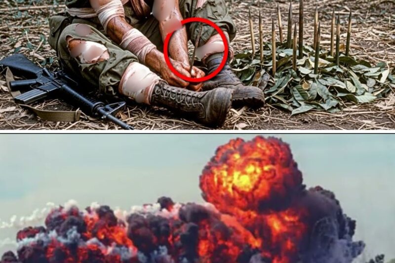 Vietnam’s worst INJURIES for US Soldiers